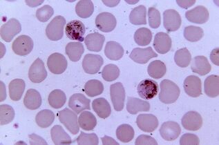 Malária plazmodium