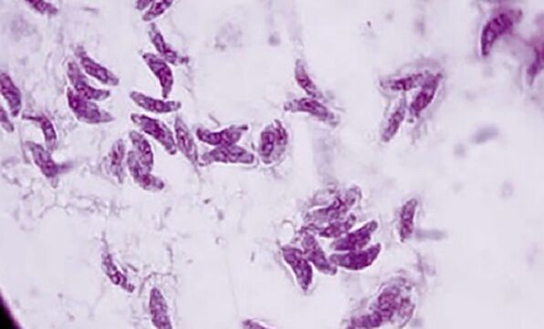 prvok parazit toxoplazma gondii pôvodca toxoplazmózy