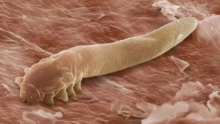 Parazity v ľudskom tele