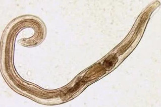 ľudské parazity pinworm